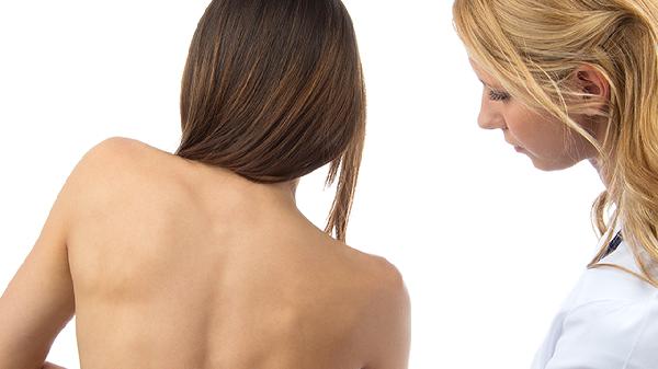 紅斑狼瘡有什么蔬菜不能吃