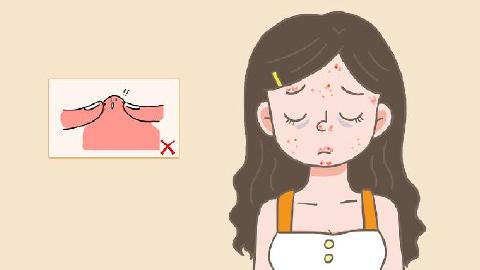 祛痘痘怎么不留痘印吖