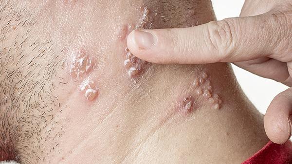 35周繞頸兩周會(huì )自己繞出來(lái)嗎