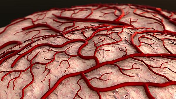 支氣管鱗狀細胞癌早期癥狀是什么