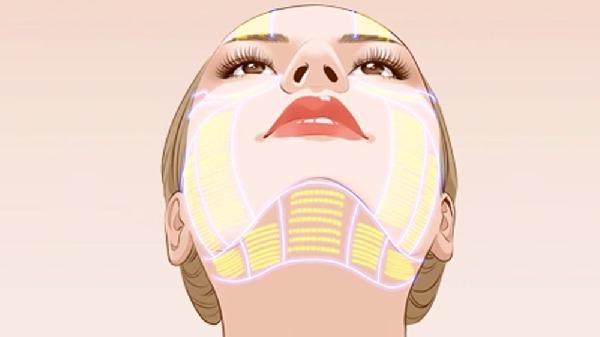 墊下巴整形有哪些適應證