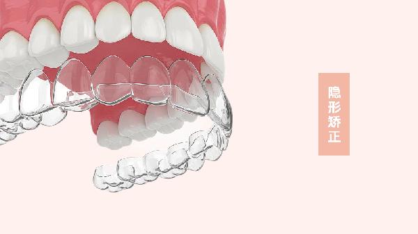 牙齒矯正后疼痛難忍怎么辦