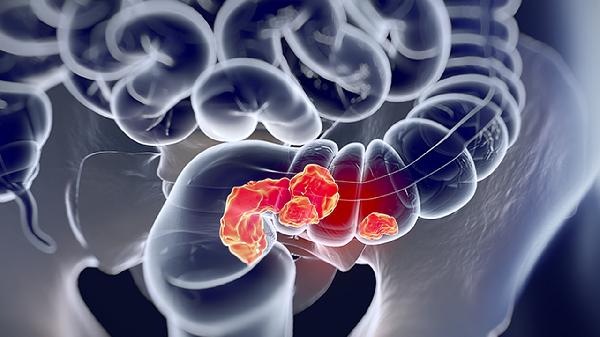 草本湯小腸湯有營(yíng)養(yǎng)嗎