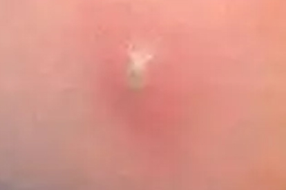 脖子皮膚松弛是什么原因