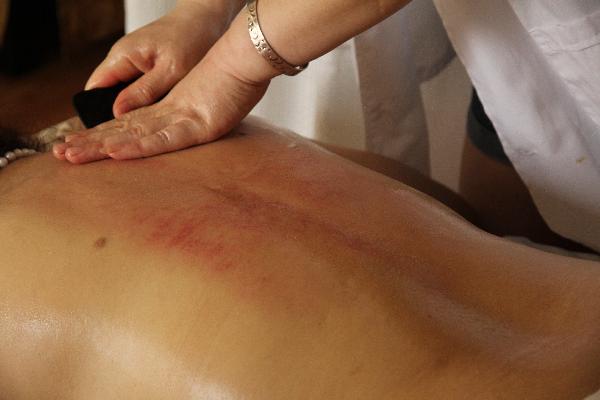 中醫(yī)認為痱子是怎么得的