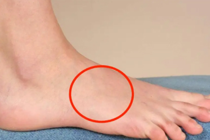 腳底后半部分疼痛是什么原因