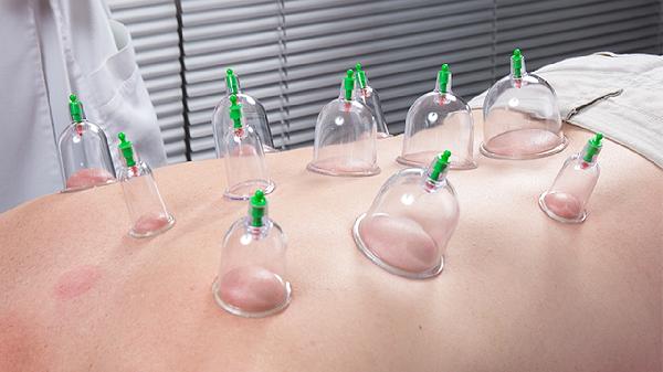 拔罐后三天瘦了10斤正常嗎