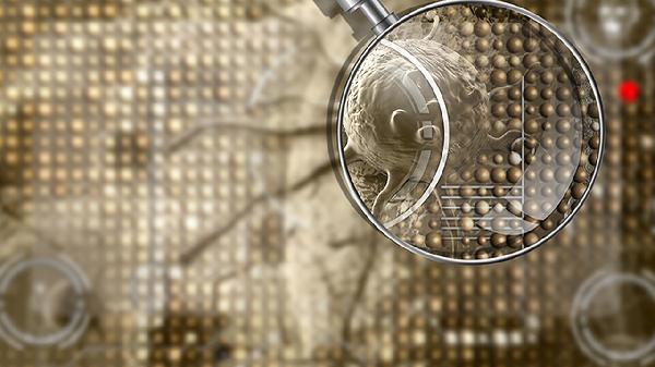 支氣管癌常見早期癥狀有