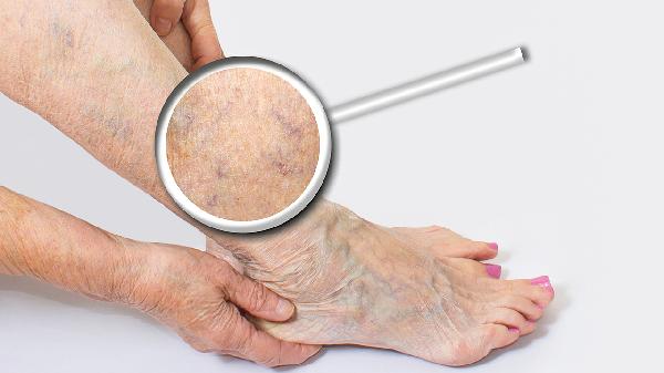 大象腿變成筷子腿的方法是什么