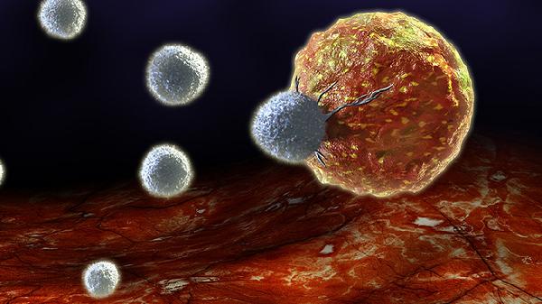 囊腫手術一般住院幾天