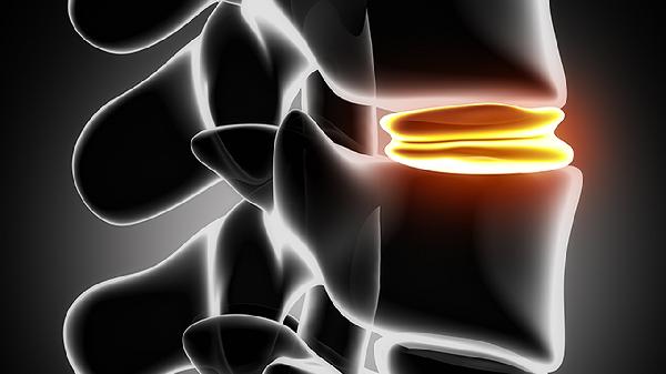 頜骨矯正做完要多久時(shí)間