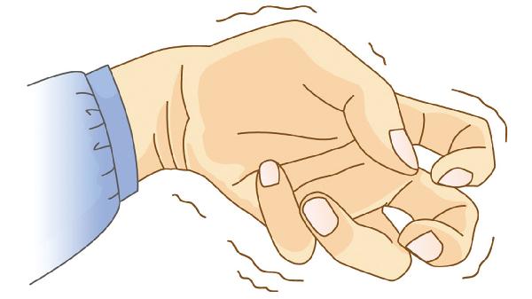 沉迷網(wǎng)絡(luò)可導(dǎo)致青少年癲癇如何防治青少年癲癇