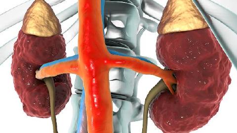 腎炎對(duì)身體有什么不利影響