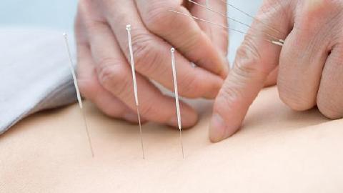 眼瞼埋線的優(yōu)點(diǎn)