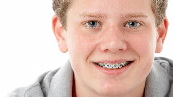 兒童牙齒矯正的最佳時(shí)間和方法