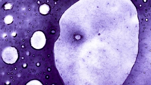 細菌性陰炎如何根治介紹幾種有效療法