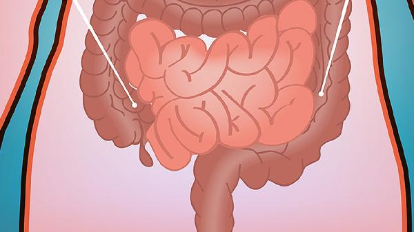 預(yù)防直腸脫垂的鍛煉方法