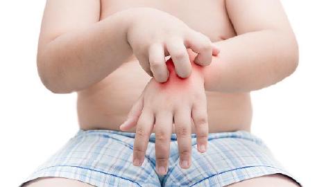 胃病也會引起蕁麻疹蕁麻疹患者如何用藥