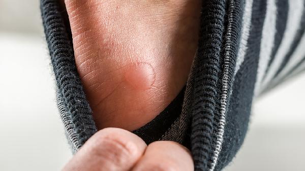 男人一年四季用開水泡枸杞對(duì)身體好嗎