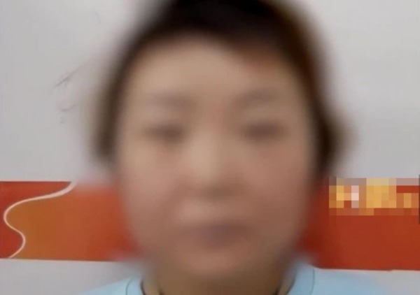 1年内越变越丑，31女士查出罕见病：库欣综合征