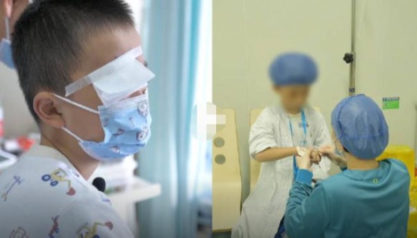 8岁男童右眼感染20多条螨虫！医生为其做角膜移植