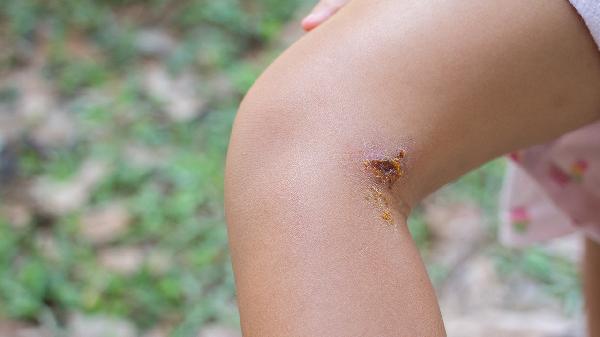 男性隱睪可引起精神創(chuàng  )傷