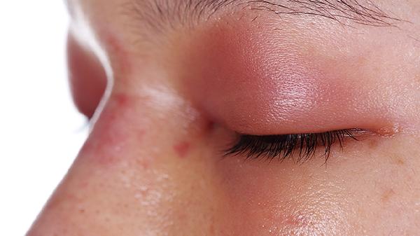 六個壞習慣讓斑點爬上你的臉