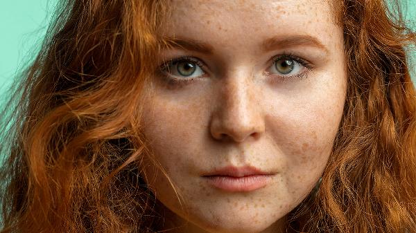 雀斑激光需要多少錢