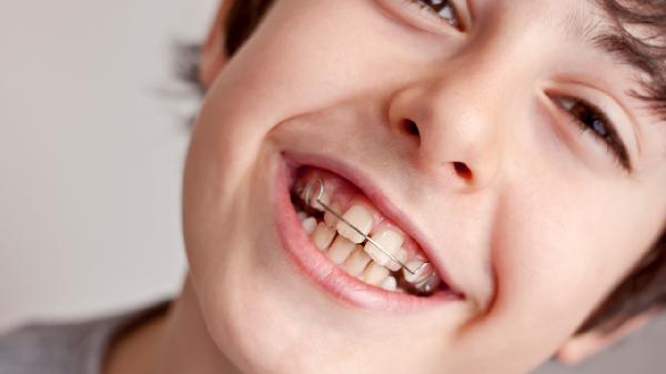 儿童牙齿矫正需要多长时间