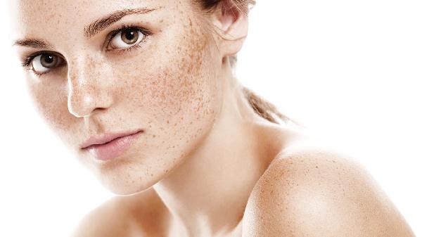 6个坏习惯让斑点爬上你的脸