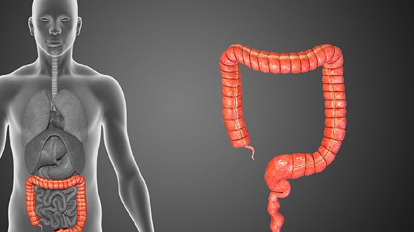 便秘導致腸狹窄的檢查