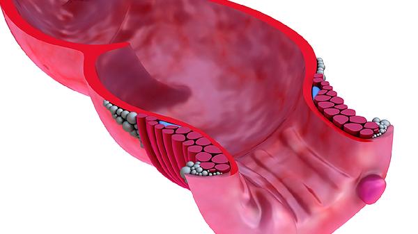 血友病患者的生活常識