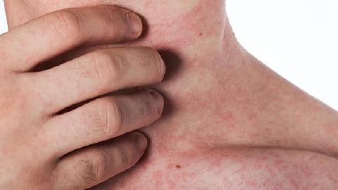 艾滋病的预防措施