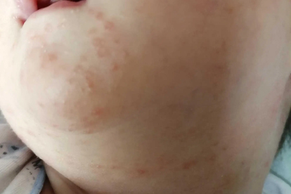 新生儿刚出生都做哪些检查