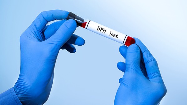 男性前列腺炎有多少人得 男人前列腺炎很普遍吗