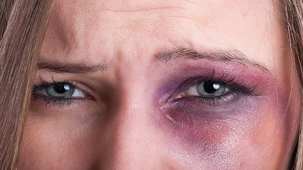 脂肪填充臉部多少錢(qián)