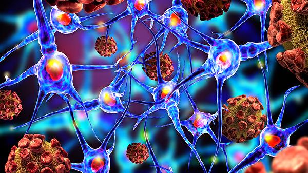 脊髓小腦性共濟(jì)失調(diào)