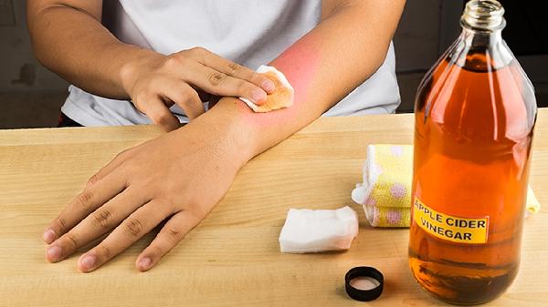 碘酒和碘伏的區(qū)別