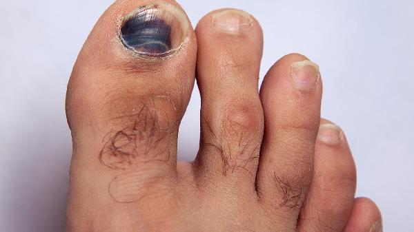 手指甲沒(méi)有月牙