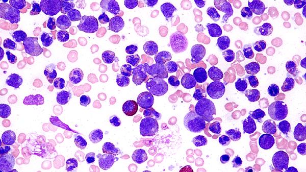 淋巴細(xì)胞比率降低說(shuō)明什么