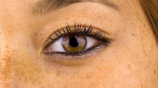 祛斑有效的方法