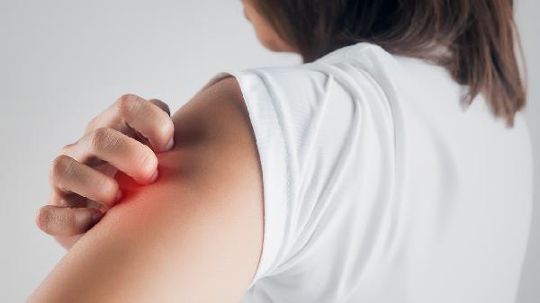 特應(yīng)性皮炎癥狀是什么