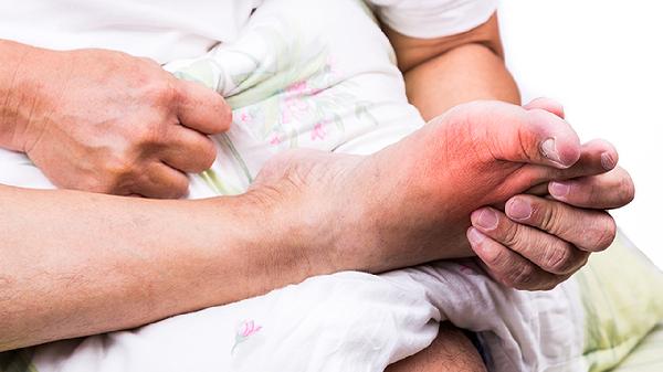 拇外翻手术截骨的方法