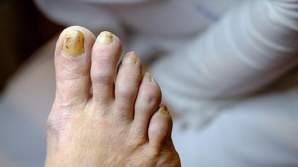 氣血不足吃什么補(bǔ)最快