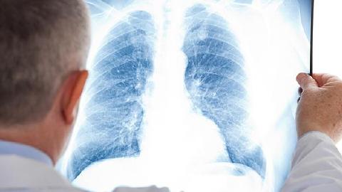 左肺上叶炎症严不严重