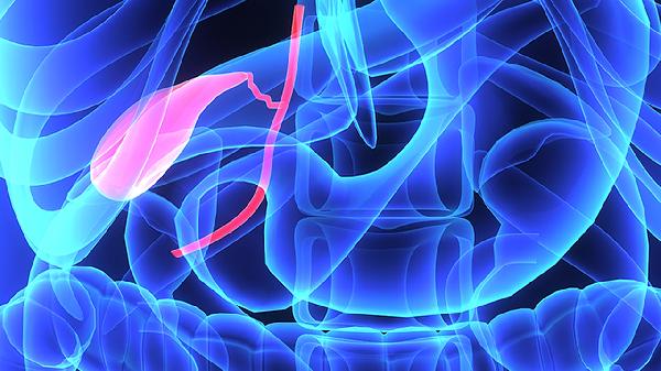 胆红素升高的三个原因 或与胆道被阻塞有关系