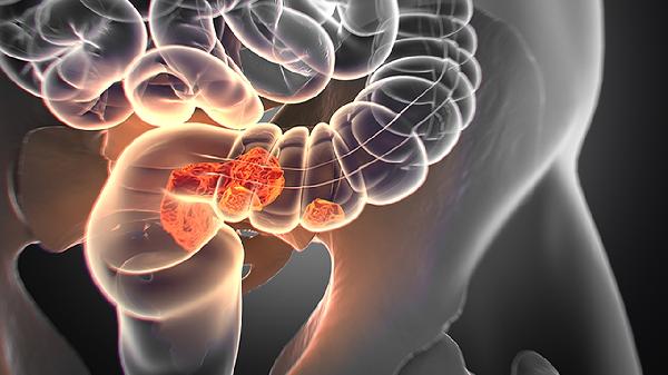 利活腸道新發(fā)現！三大專(zhuān)家揭秘免疫力提升的關(guān)鍵