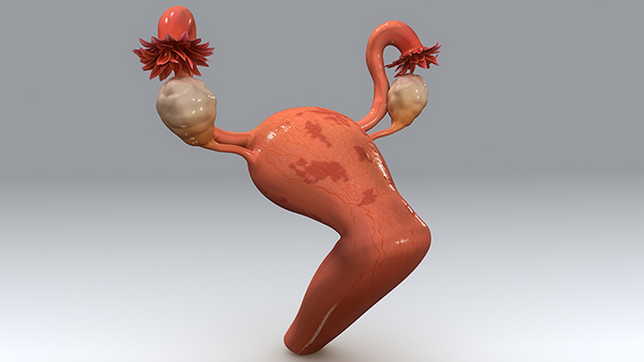 宫颈囊肿会引起出血吗