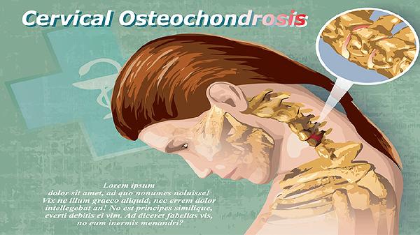 兒童先天頸椎畸形癥狀