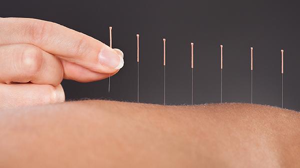 眼肌痙攣可以針灸嗎